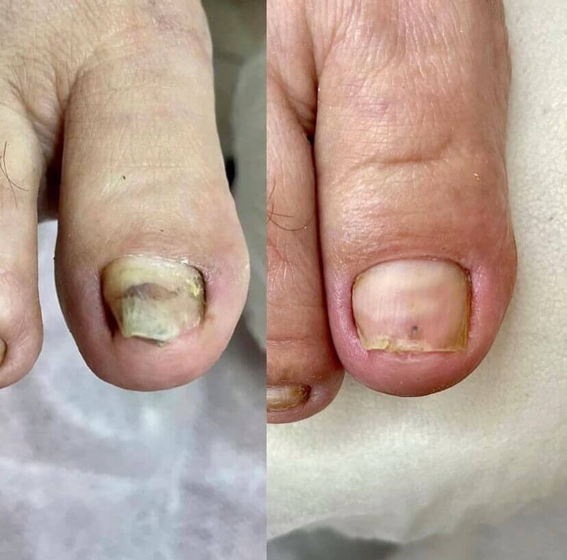 Agate - 140 days